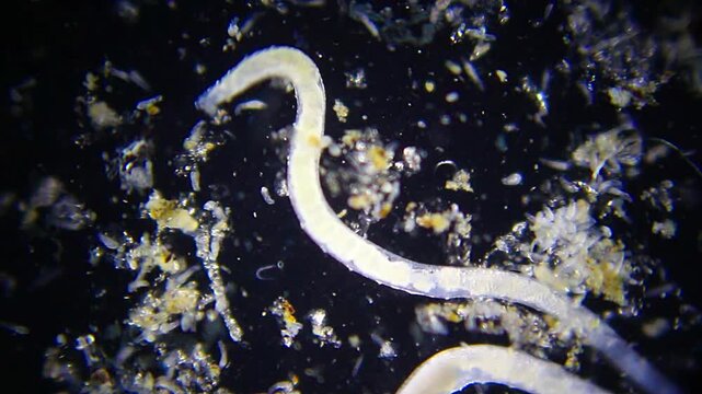 Two large annelid worms surrounded by rotifers under 40x darkfield microscopy. Detailed 4K scientific stock footage of freshwater microfauna interaction.