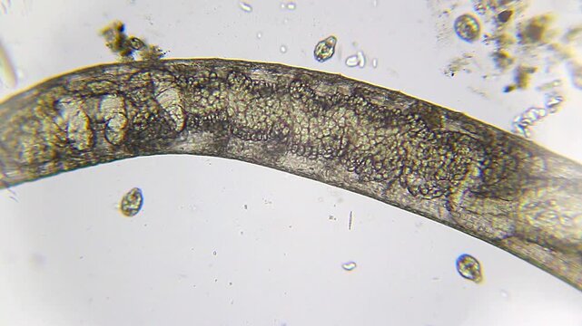 Motionless annelid worm in panoramic view under 100x brightfield microscopy. Detailed 4K scientific stock footage of segmented worm anatomy.