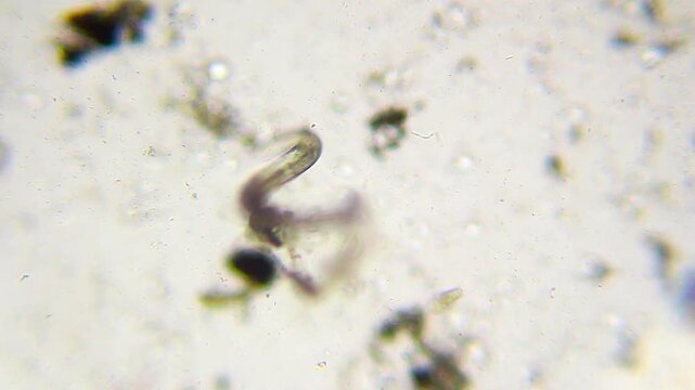 Moving nematode with visible internal eggs under 100x brightfield microscopy. Detailed 4K scientific stock footage of parasitic worm activity and internal structure.