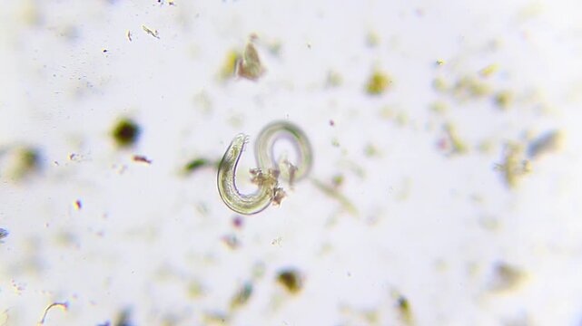 Nematode moving with snake-like bending motions under 100x brightfield microscopy. Detailed 4K scientific stock footage of active parasitic worm behavior.