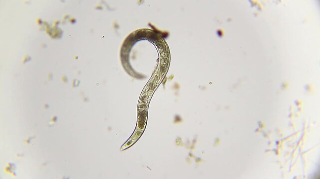 Moving nematode with visible internal eggs under 100x brightfield microscopy. Detailed 4K scientific stock footage of parasitic worm activity and internal anatomy.