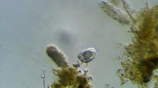 Unicellular organism - Ciliate moving in water