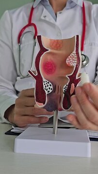 A suppository and a rectum. A proctologist inserts a rectal suppository and an artificial model of the human rectum