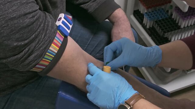 Close-up of nurses gloved hand inserting butterfly needle into vein and collecting blood in tube tourniquet released. Preventive heals check and blood donation concept.