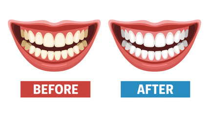 Naklejka premium An illustrative comparison clearly displays the before and after effects of teeth whitening treatment.
