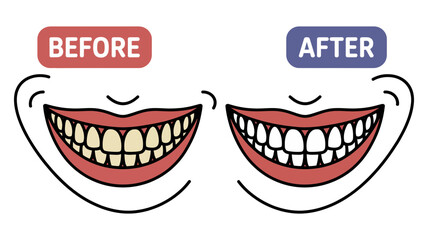 Naklejka premium A charming cartoon illustration demonstrates the impressive before and after results of teeth whitening.