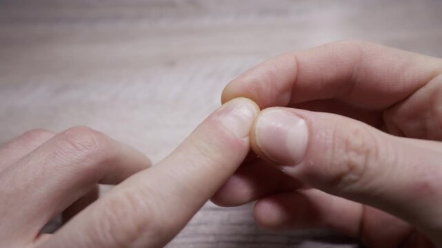A person's hands are shown in a close-up as they nervously pick at their fingernails and cuticles. Concept of mental health, anxiety, stress, and obsessive-compulsive behavior.