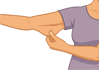 Png illustration of person pinching arm isolated on transparent background. concept of body awareness, skin elasticity, health check. medical and educational diagram