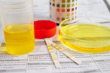 Urinalysis, urine cup with reagent strip pH paper test and comparison chart in laboratory.
