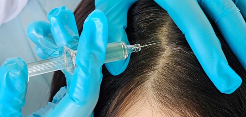 Scalp treatment session in a modern clinic with a focus on hair restoration techniques