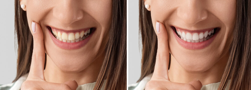 Young woman with beautiful smile on light background, closeup