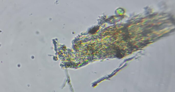 live microscopic observation of a natural micro ecosystem contained within a drop of freshwater