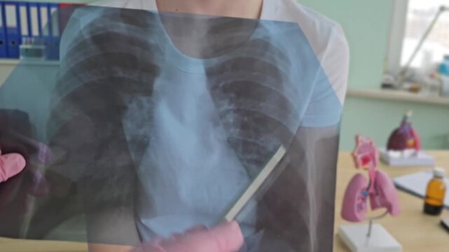 X-ray examination of a person  lungs in a school healthcare class