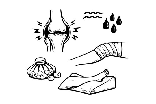 Knee pain relief techniques: ice pack, compression, elevation, water therapy illustration