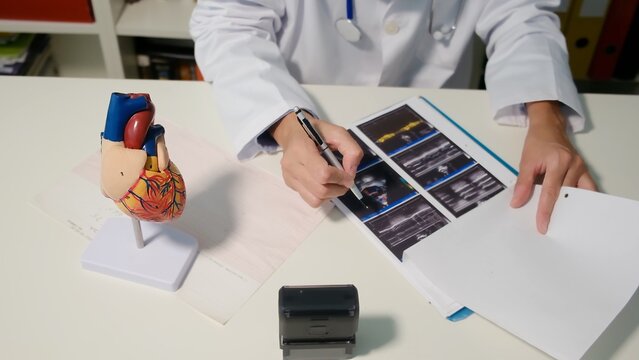 Doctor in a white coat reviewing cardiac ultrasound images and ekg printouts, analyzing results for heart health, diagnosis, and medical care with a human heart model on the desk