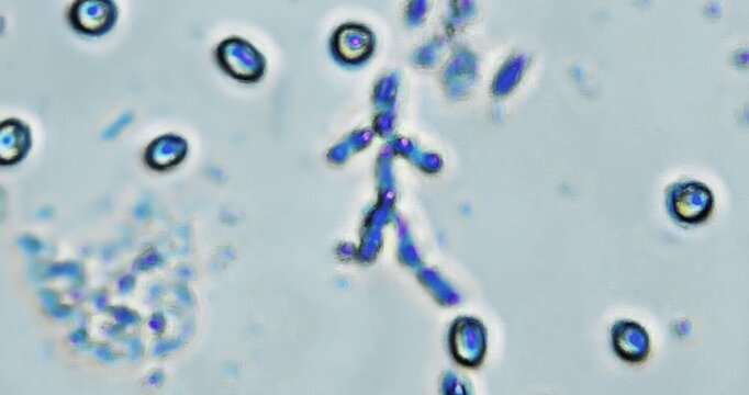 live microscopic observation of a natural micro ecosystem contained within a drop of freshwater