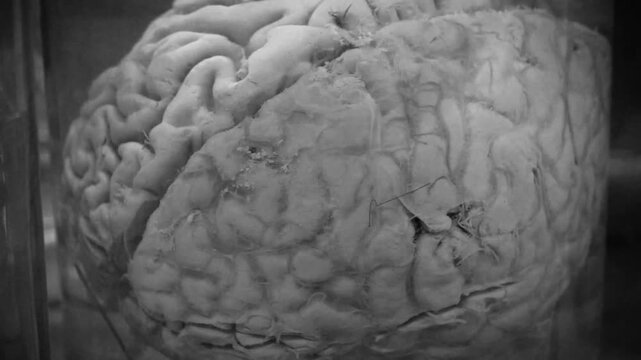 Human brain in flask. Brain in vat. Human brain in glass jar with formaldehyde for medical research. Anatomy of brain. 4K video in retro style with cinema effects, old filming
