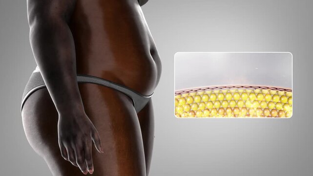 Black woman lose weight, burn belly fat, fitness and body shaping by fat cell burning, close-up of waistline reduction, obese people become slimmer and healthy, body management, 3D. Alpha channel.