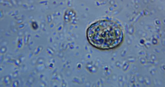 real microscopic footage showing living microorganisms in natural freshwater, observed under high magnification using smartphone microscopy