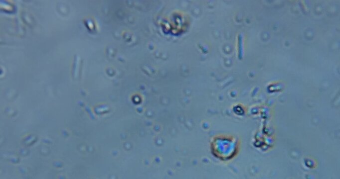 real microscopic footage showing living microorganisms in stagnant pond water, observed under a microscope