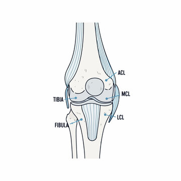 Anatomical diagram of the human knee joint ligaments and bones (Tibia, Fibula, ACL, MCL, LCL) in a simplified, educational illustration style.