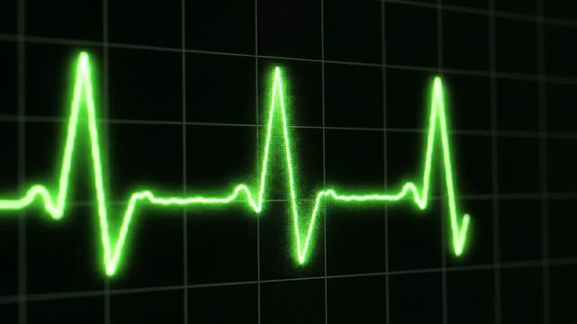 Close-Up ECG Waveform with Heartbeat Cycle