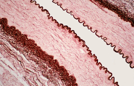 Muscular artery
