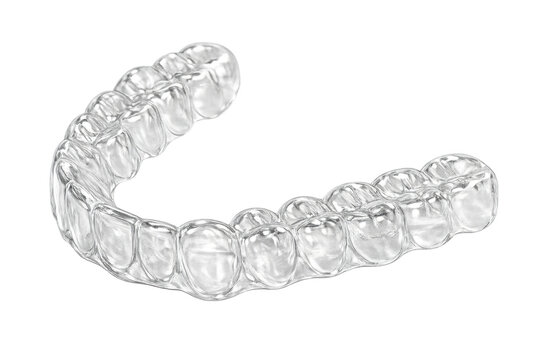 Clear aligner showing invisible dental teeth straightening treatment