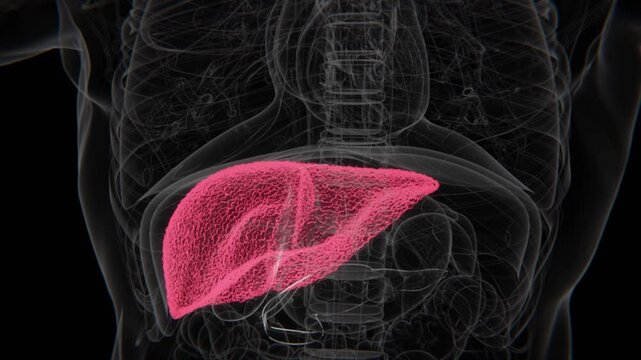 Liver Cirrhosis indication in Xray HD Video | Liver Cirrhosis showing in X-Ray Video