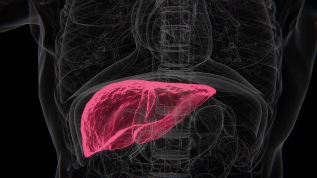 Fatty Liver in HD Video | Fatty Liver Disease (NAFLD) Indication in HD Video