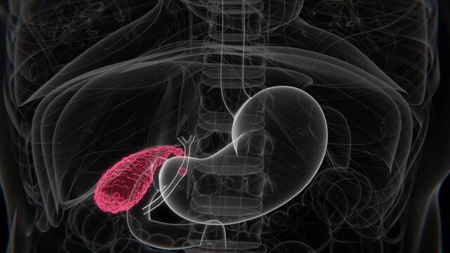 Cholecystitis Indication X-Ray Video | Gallbladder Infection indication in Vertical HD X-Ray Video