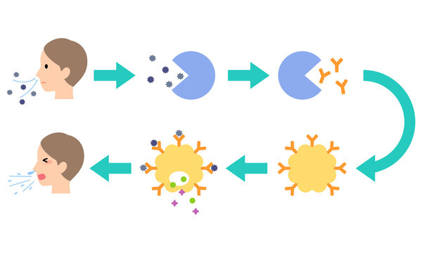 アレルギー発症のしくみ　花粉症のメカニズム