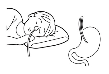 Endoscopy Examination with Stomach Anatomy Line Art Medical Illustration for Gastroenterology and Healthcare Education