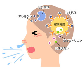 アレルギー発症のしくみ　花粉症のメカニズム