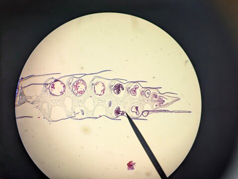 A light micrograph showing the longitudinal section (L.S.) of the club moss- Selaginella sp., strobilus or cone. This structure is a reproductive part of the plant, containing mega and micro spores.