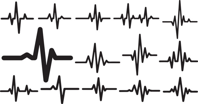 Collection of various ECG heartbeat waveform patterns on screen