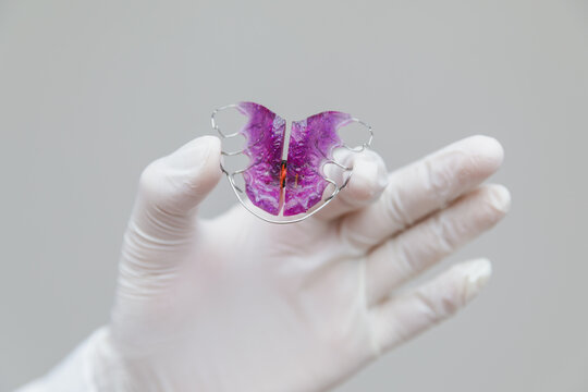 Dentist in white medical glove holding purple orthodontic plate for teeth alignment correction, professional pediatric dentistry and orthodontic treatment concept