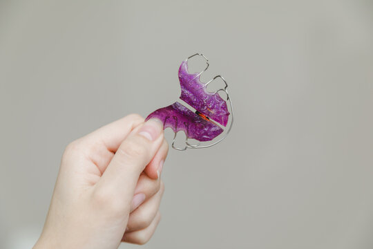 Close up of patient hand holding purple removable orthodontic plate for teeth alignment, pediatric dentistry and bite correction concept