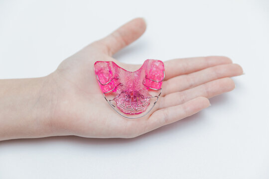Pink removable orthodontic plate for teeth alignment on child's open palm, pediatric dentistry and bite correction treatment concept
