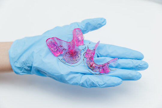 An orthodontist holds two pink removable dental plates for the upper and lower jaws in a blue medical glove - the concept of pediatric dentistry and orthodontic correction, twin block