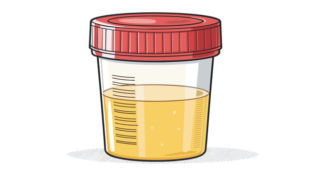 Medical specimen cup filled with urine on white background  