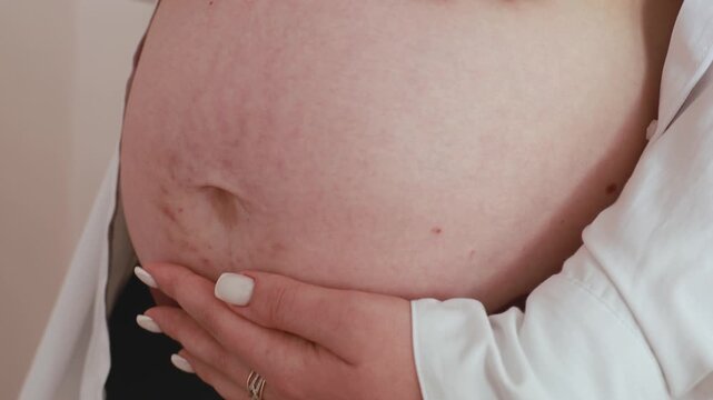Close up of woman touching her stomach with visible stretch marks. Real body, postpartum recovery, self acceptance and natural beauty concept.