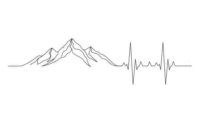 Normal Electrocardiogram (ECG) Waveform
