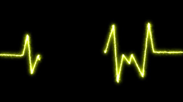 An eye opening heartbeat graph in flash yellow waves, 4k format clip, best for websites, music parties,looping and thumbnails