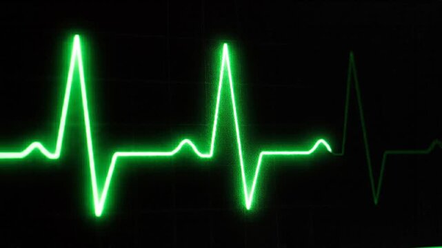 Close-Up ECG Waveform with Clear Heartbeat