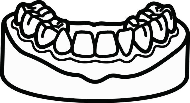 Black and white line drawing of a dental model of upper teeth on a base