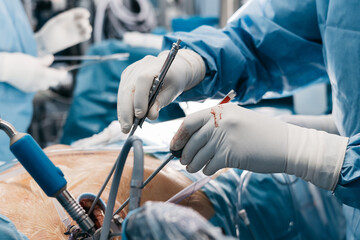 Cardiac operation with professional surgeons and medical instruments in modern operating theater. Advanced medicine concept.