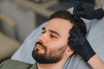 Patient receiving hair transplant consultation planning treatment