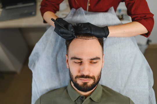 Patient receiving hair transplant procedure in clinic