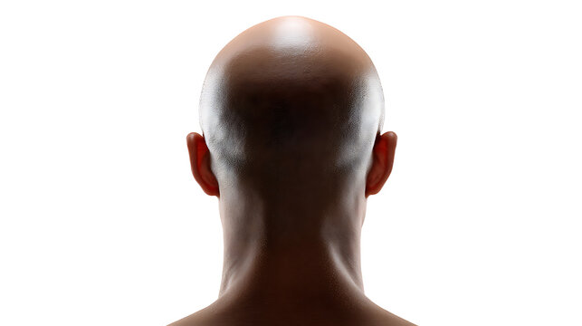 A close-up shot of a bald head from the back